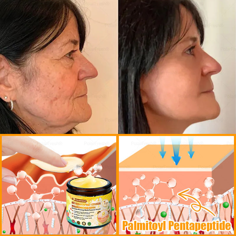 🔥 Made & Shipped from UK | Clinically Proven: PolarFresh® Bee Venom Wrinkle-Firming Multi-purpose Cream with bee venom peptides, botulinum toxin, hyaluronic acid, and collagen💧. Targets wrinkles, fine lines, sagging, stretch marks, dark spots and more