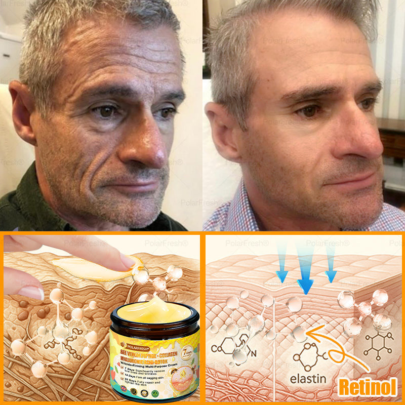 🔥 Made & Shipped from UK | Clinically Proven: PolarFresh® Bee Venom Wrinkle-Firming Multi-purpose Cream with bee venom peptides, botulinum toxin, hyaluronic acid, and collagen💧. Targets wrinkles, fine lines, sagging, stretch marks, dark spots and more