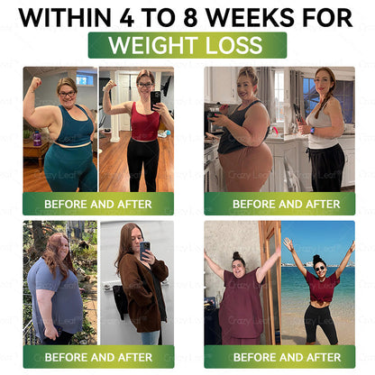 UK Clinically Proven|Official Store | CrazyLeaf® SMGT-GLP-1 Nano Microneedle Patch with Collagen & Matrixyl 3000 丨Targets Obesity, Loose Skin, High Blood Pressure, Diabetes, Fatty Liver, Joint Pain, Brain Fog, Low Energy, Body Aches, and More