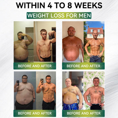 UK Clinically Proven|Official Store | CrazyLeaf® SMGT-GLP-1 Nano Microneedle Patch with Collagen & Matrixyl 3000 丨Targets Obesity, Loose Skin, High Blood Pressure, Diabetes, Fatty Liver, Joint Pain, Brain Fog, Low Energy, Body Aches, and More