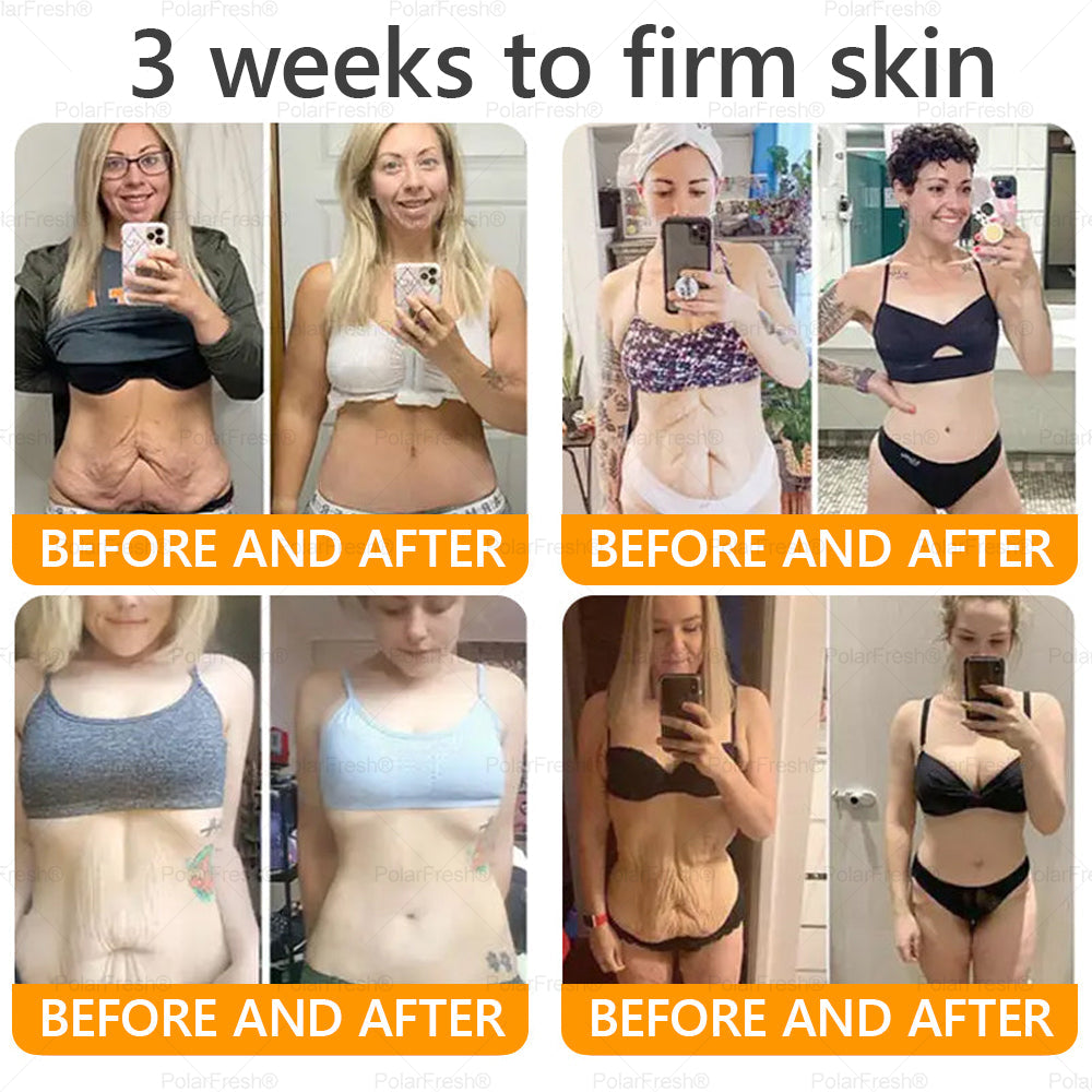 🔥 Made & Shipped from UK | Clinically Proven: PolarFresh® Bee Venom Wrinkle-Firming Multi-purpose Cream with bee venom peptides, botulinum toxin, hyaluronic acid, and collagen💧. Targets wrinkles, fine lines, sagging, stretch marks, dark spots and more