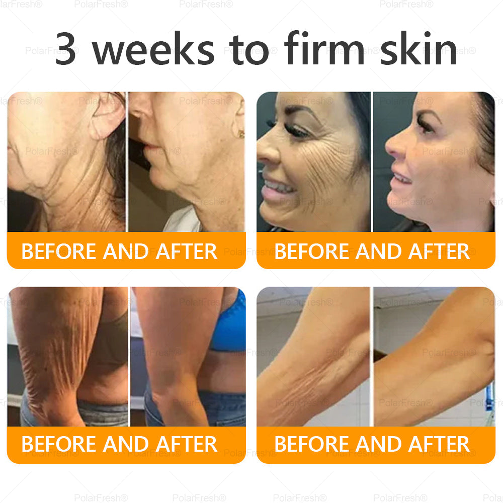 🔥 Made & Shipped from UK | Clinically Proven: PolarFresh® Bee Venom Wrinkle-Firming Multi-purpose Cream with bee venom peptides, botulinum toxin, hyaluronic acid, and collagen💧. Targets wrinkles, fine lines, sagging, stretch marks, dark spots and more